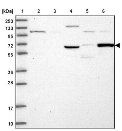 Invitrogen TCP11L2 Polyclonal Antibody 100 &mu;L; Unconjugated:Antibodies,