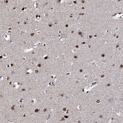 Invitrogen KIF18A Polyclonal Antibody 100 &mu;L; Unconjugated:Antibodies,