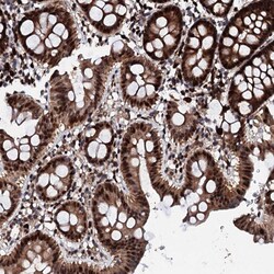 Invitrogen KIF18A Polyclonal Antibody 100 &mu;L; Unconjugated:Antibodies,