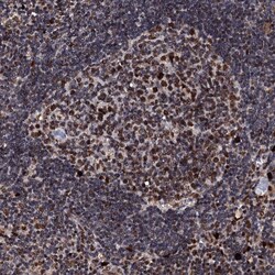 Invitrogen KIF18A Polyclonal Antibody 100 &mu;L; Unconjugated:Antibodies,