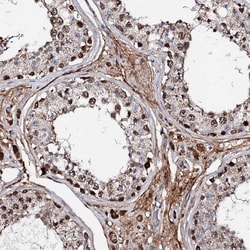 Invitrogen KIF18A Polyclonal Antibody 100 &mu;L; Unconjugated:Antibodies,