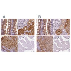 Invitrogen DAK Polyclonal Antibody 100 &mu;L; Unconjugated:Antibodies,
