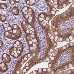 Invitrogen DAK Polyclonal Antibody 100 &mu;L; Unconjugated:Antibodies,