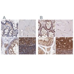 Invitrogen ANKRD13A Polyclonal Antibody 100 &mu;L; Unconjugated:Antibodies,