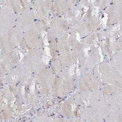 Invitrogen ANKRD13A Polyclonal Antibody 100 &mu;L; Unconjugated:Antibodies,