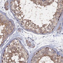 Invitrogen ANKRD13A Polyclonal Antibody 100 &mu;L; Unconjugated:Antibodies,