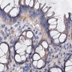 Invitrogen ANKRD13A Polyclonal Antibody 100 &mu;L; Unconjugated:Antibodies,