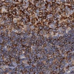 Invitrogen ANKRD13A Polyclonal Antibody 100 &mu;L; Unconjugated:Antibodies,