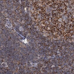 Invitrogen ANKRD13A Polyclonal Antibody 100 &mu;L; Unconjugated:Antibodies,