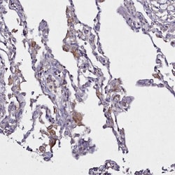 Invitrogen NCKAP1L Polyclonal Antibody 100 &mu;L; Unconjugated:Antibodies,