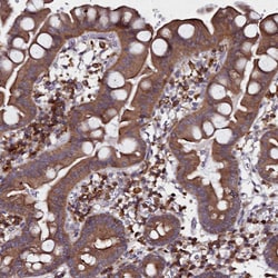 Invitrogen NCKAP1L Polyclonal Antibody 100 &mu;L; Unconjugated:Antibodies,