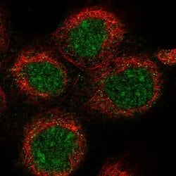 Invitrogen DDX51 Polyclonal Antibody 100 &mu;L; Unconjugated:Antibodies,