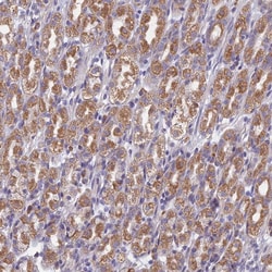 Invitrogen DDX51 Polyclonal Antibody 100 &mu;L; Unconjugated:Antibodies,