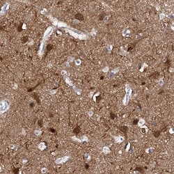 Invitrogen FBXL16 Polyclonal Antibody 100 &mu;L | Buy Online | Invitrogen&trade; | Fisher Scientific