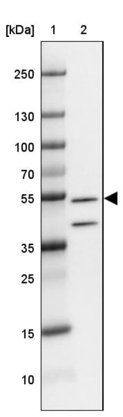 Invitrogen FBXL16 Polyclonal Antibody 100 &mu;L | Buy Online | Invitrogen&trade; | Fisher Scientific