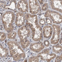Invitrogen LOH12CR1 Polyclonal Antibody 100 &mu;L; Unconjugated:Antibodies,