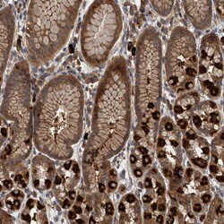 Invitrogen LOH12CR1 Polyclonal Antibody 100 &mu;L; Unconjugated:Antibodies,