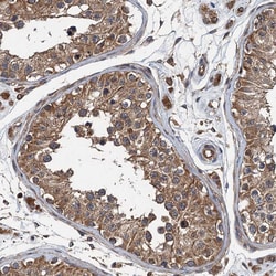 Invitrogen LOH12CR1 Polyclonal Antibody 100 &mu;L; Unconjugated:Antibodies,