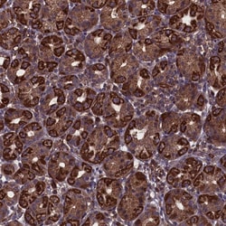 Invitrogen MYO1H Polyclonal Antibody 100 &mu;L; Unconjugated:Antibodies,