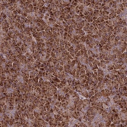 TNPO3 Polyclonal Antibody:Anticuerpos