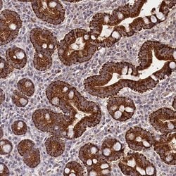 Invitrogen TAZ Polyclonal Antibody 100 &mu;L; Unconjugated:Antibodies,