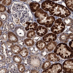 Invitrogen ALKBH7 Polyclonal Antibody 100 &mu;L; Unconjugated:Antibodies,