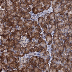 Invitrogen ALKBH7 Polyclonal Antibody 100 &mu;L; Unconjugated:Antibodies,