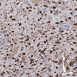 Invitrogen ALKBH7 Polyclonal Antibody 100 &mu;L; Unconjugated:Antibodies,