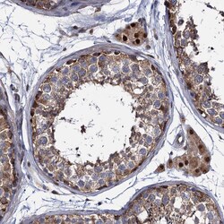Invitrogen ALKBH7 Polyclonal Antibody 100 &mu;L; Unconjugated:Antibodies,