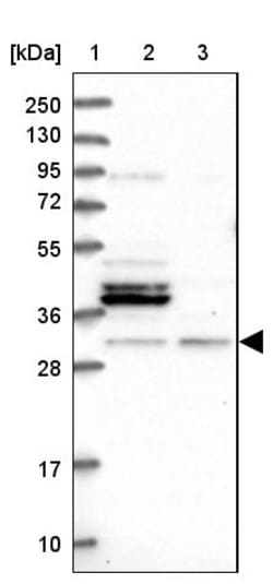 Invitrogen FUS2 Polyclonal Antibody 100 &mu;L; Unconjugated:Antibodies,