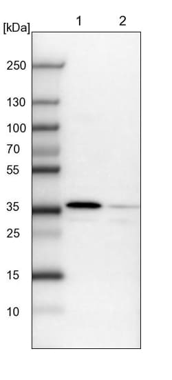 Invitrogen FUS2 Polyclonal Antibody 100 &mu;L; Unconjugated:Antibodies,