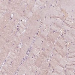 Invitrogen SPATA6L Polyclonal Antibody 100 &mu;L; Unconjugated:Antibodies,