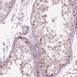 Invitrogen SPATA6L Polyclonal Antibody 100 &mu;L; Unconjugated:Antibodies,