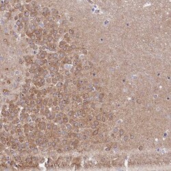 Invitrogen RGS7BP Polyclonal Antibody 100 &mu;L; Unconjugated:Antibodies,