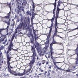 Invitrogen SPEF2 Polyclonal Antibody 100 &mu;L; Unconjugated:Antibodies,