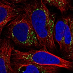 Invitrogen TM9SF3 Polyclonal Antibody 100 &mu;L; Unconjugated:Antibodies,
