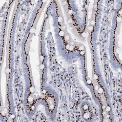 Invitrogen TM9SF3 Polyclonal Antibody 100 &mu;L; Unconjugated:Antibodies,