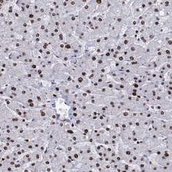 Invitrogen DCPS Polyclonal Antibody 100 &mu;L; Unconjugated:Antibodies,
