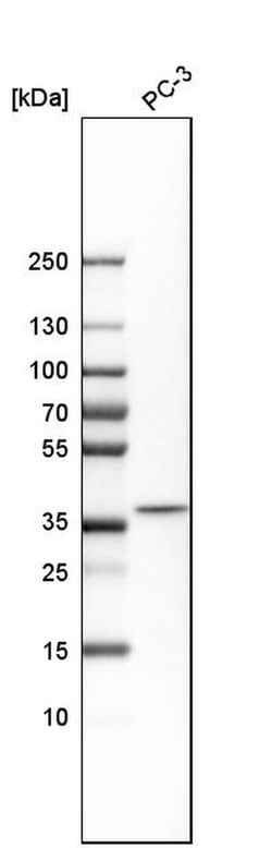 Invitrogen DCPS Polyclonal Antibody 100 &mu;L; Unconjugated:Antibodies,