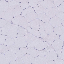 Invitrogen SCP3 Polyclonal Antibody 100 &mu;L; Unconjugated:Antibodies,