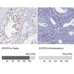 Invitrogen SCP3 Polyclonal Antibody 100 &mu;L; Unconjugated:Antibodies,