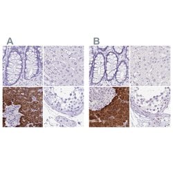 Invitrogen ERP27 Polyclonal Antibody 100 &mu;L; Unconjugated:Antibodies,