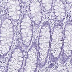 Invitrogen ERP27 Polyclonal Antibody 100 &mu;L; Unconjugated:Antibodies,
