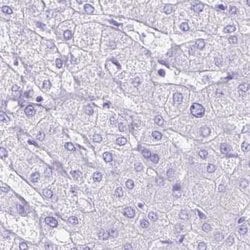 Invitrogen ERP27 Polyclonal Antibody 100 &mu;L; Unconjugated:Antibodies,