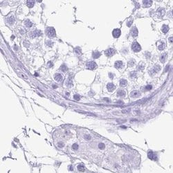 Invitrogen ERP27 Polyclonal Antibody 100 &mu;L; Unconjugated:Antibodies,