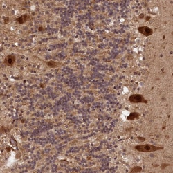 Invitrogen VPS51 Polyclonal Antibody 100 &mu;L; Unconjugated:Antibodies,