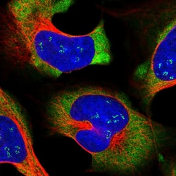 Invitrogen LARP4 Polyclonal Antibody 100 &mu;L; Unconjugated:Antibodies,