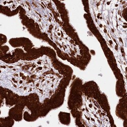 Invitrogen LARP4 Polyclonal Antibody 100 &mu;L; Unconjugated:Antibodies,