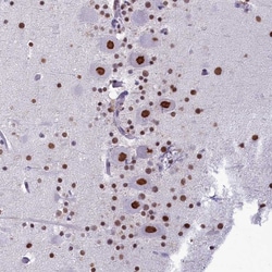 Invitrogen PARPBP Polyclonal Antibody 100 &mu;L; Unconjugated:Antibodies,