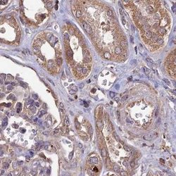 Invitrogen RCCD1 Polyclonal Antibody 100 &mu;L; Unconjugated:Antibodies,